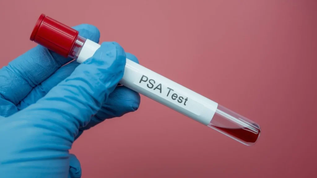 Psa Blood test Meaning