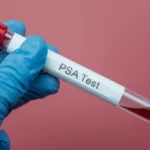Psa Blood test Meaning